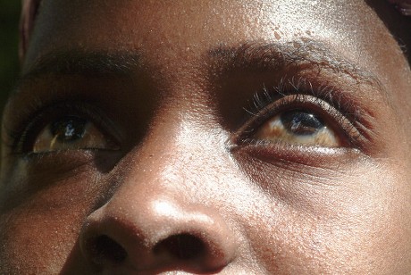 Santé oculaire : la BID finance un centre de référence pour le glaucome et la rétinopathie diabétique au Togo